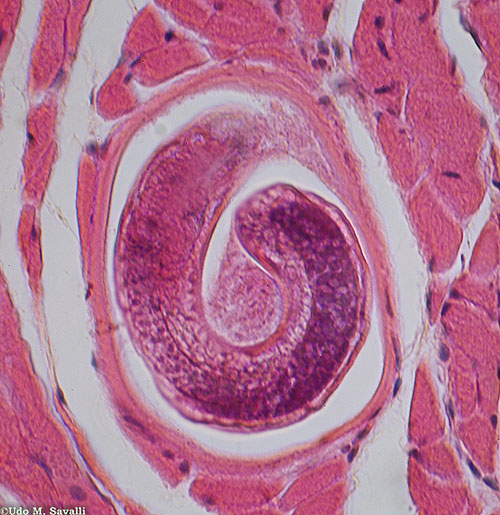 Личинки трихинеллы. Трихинелла спиральная - Trichinella spiralis.